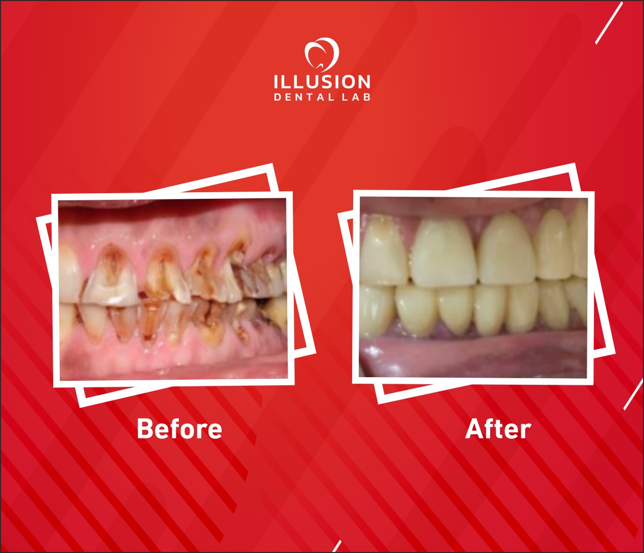 smile transformation